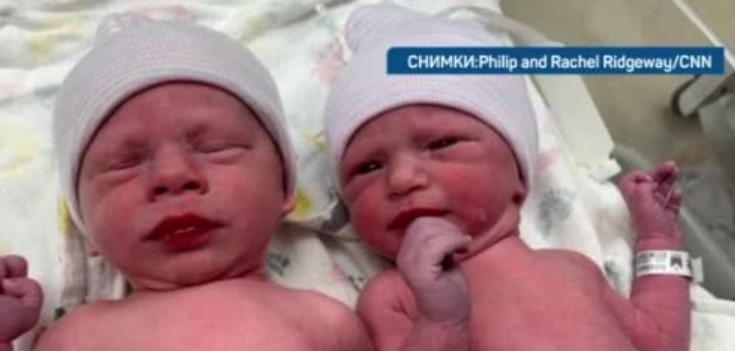 Постижение на човечеството родиха се първите в света близнаци